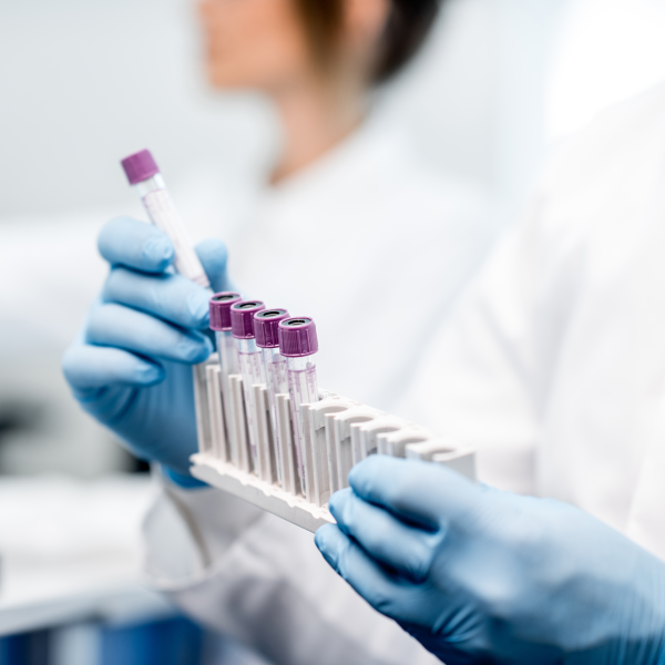 Hands placing test tubes in the holder